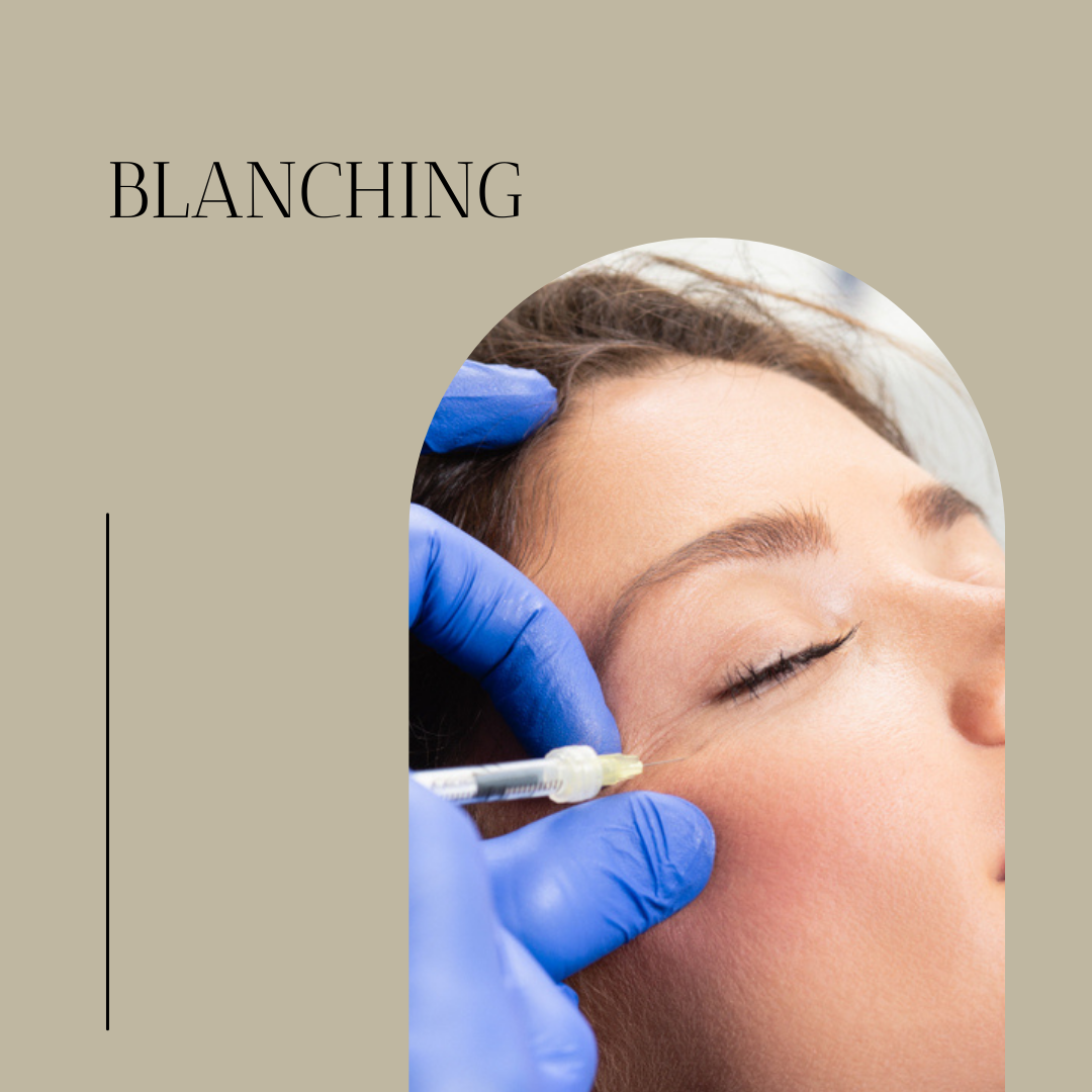 Blanching, tratamiento de arrugas finas